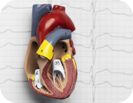 Blood pressure management tips